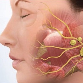 Sintomas que podem indicar um câncer de glândulas salivares