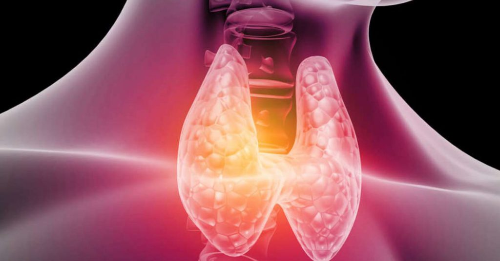 Nódulo na tireoide Quando é hora de considerar a cirurgia